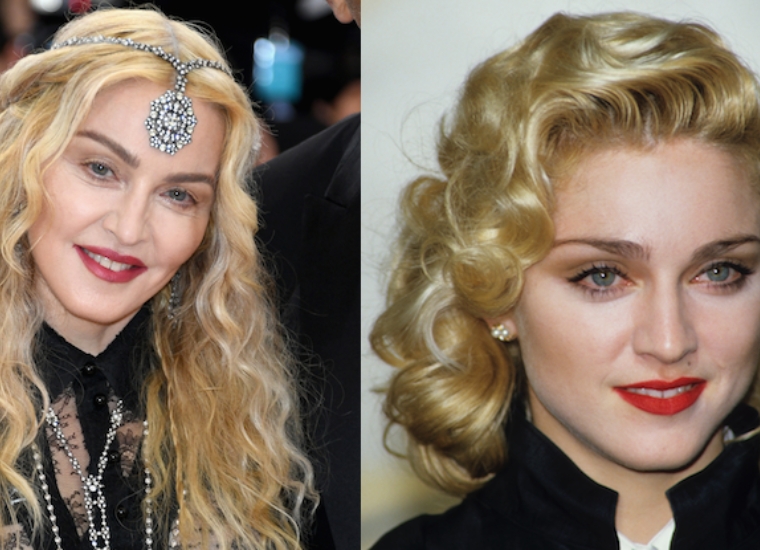 Madonna Plastic Surgery 2022