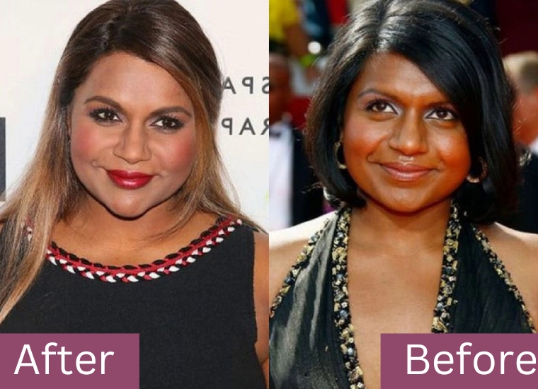 Mindy Was Never Happy With Her Facial Looks